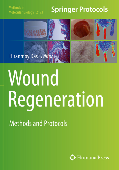 Wound Regeneration - 