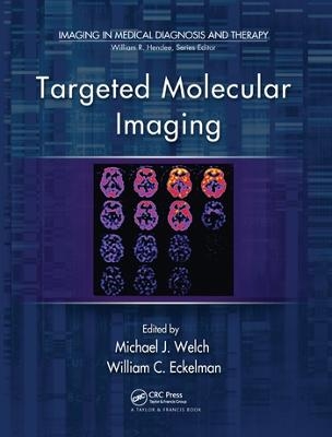 Targeted Molecular Imaging - 