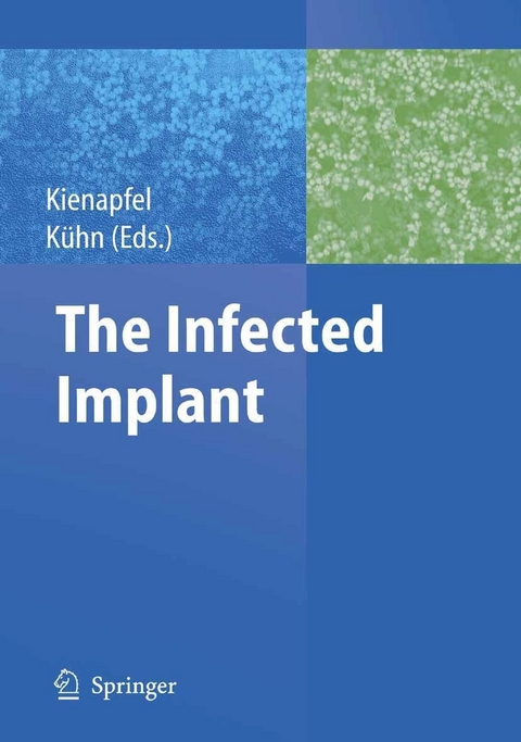 The Infected Implant - 
