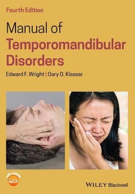 Manual of Temporomandibular Disorders - Edward F. Wright, Gary D. Klasser
