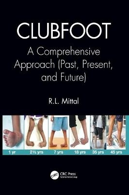 Clubfoot - R. L. Mittal