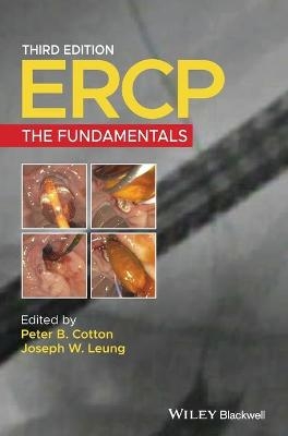 ERCP - 