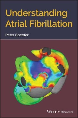 Understanding Atrial Fibrillation - Peter Spector