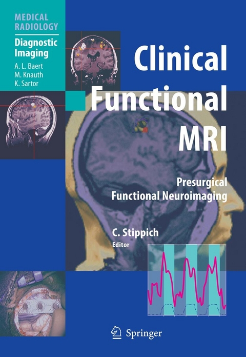 Clinical Functional MRI - 