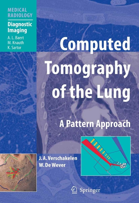 Computed Tomography of the Lung - Johny A. Verschakelen, Walter de Wever