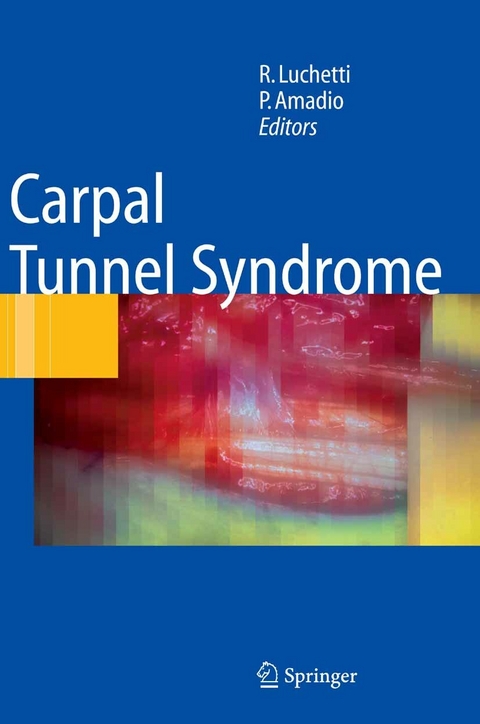 Carpal Tunnel Syndrome - 