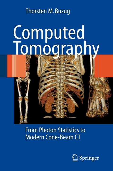 Computed Tomography - Thorsten M. Buzug