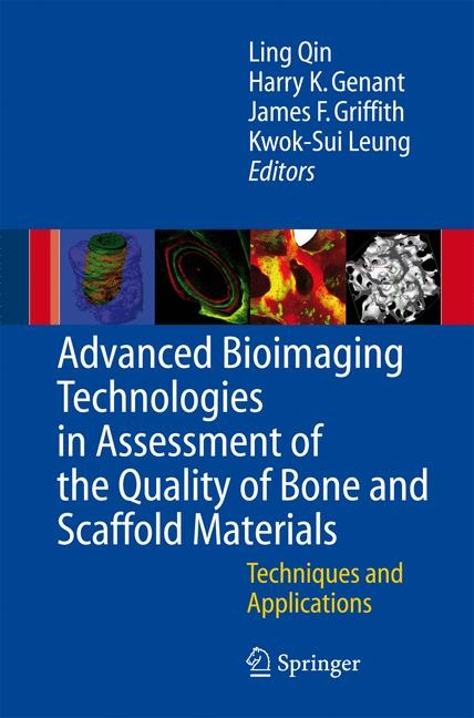 Advanced Bioimaging Technologies in Assessment of the Quality of Bone and Scaffold Materials - 