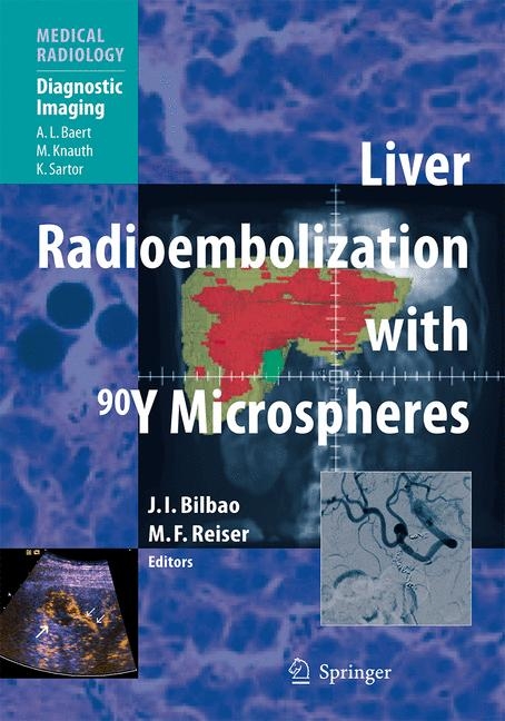 Liver Radioembolization with 90Y Microspheres - 