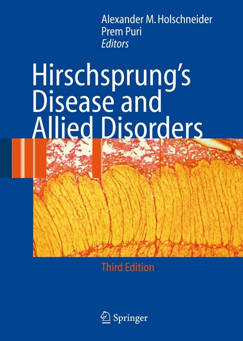 Hirschsprung's Disease and Allied Disorders - 