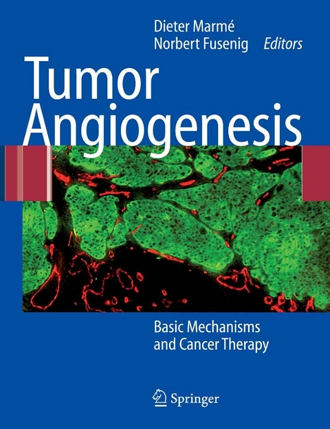 Tumor Angiogenesis - 