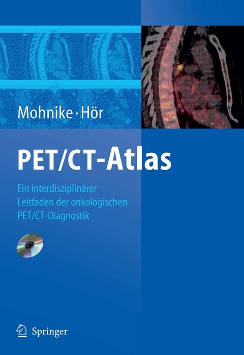 PET/CT-Atlas - 