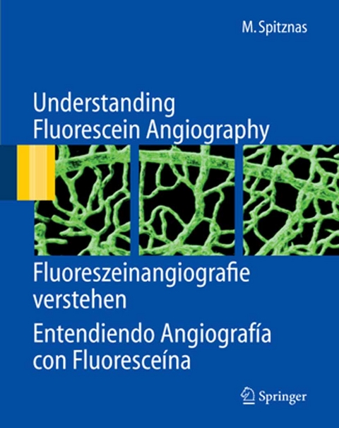 Understanding Fluorescein Angiography, Fluoreszeinangiografie verstehen, Entendiendo Angiografía con Fluoresceína - Manfred Spitznas