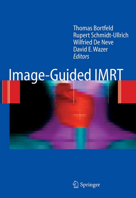 Image-Guided IMRT - 