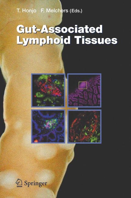 Gut-Associated Lymphoid Tissues - 