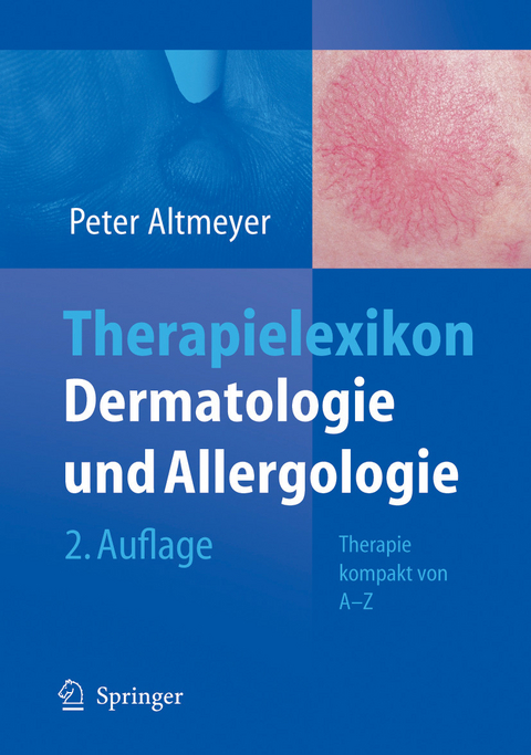 Therapielexikon Dermatologie und Allergologie - Peter Altmeyer