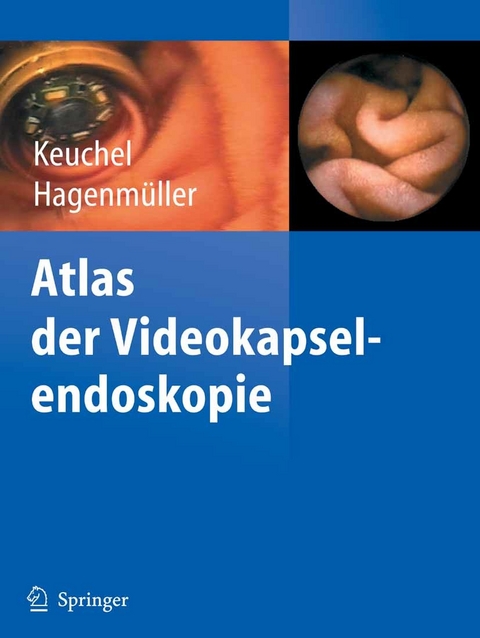 Atlas der Videokapselendoskopie - 