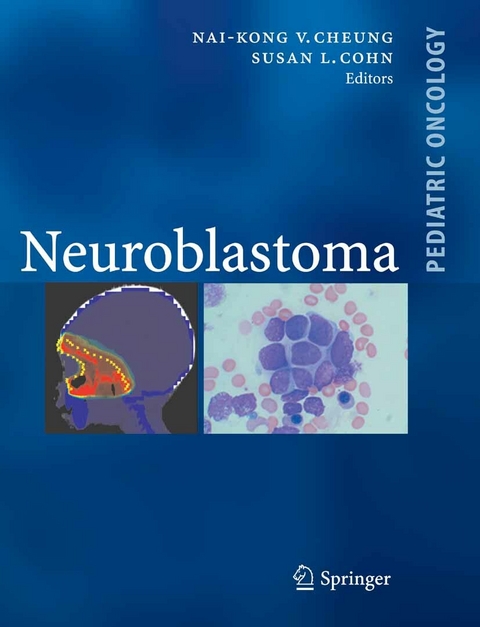 Neuroblastoma - 