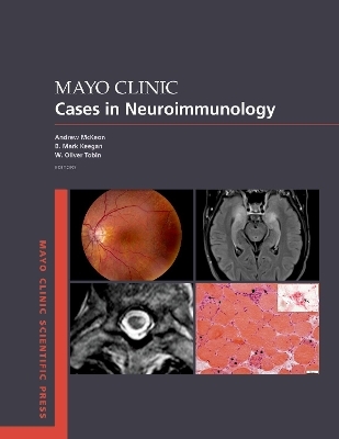 Mayo Clinic Cases in Neuroimmunology - Andrew McKeon, B. Mark Keegan, W. Oliver Tobin