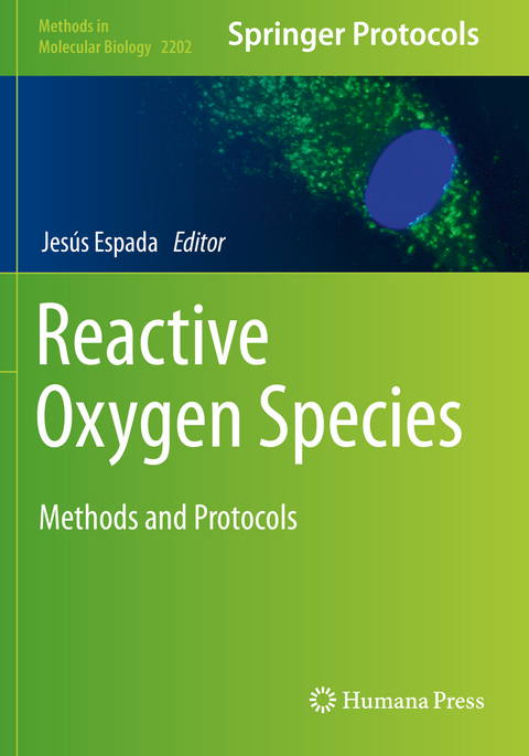 Reactive Oxygen Species - 