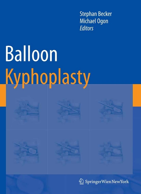 Balloon Kyphoplasty - 