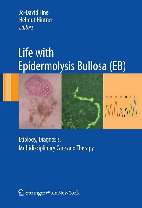 Life with Epidermolysis Bullosa (EB) -  Jo-David Fine,  Helmut Hintner.