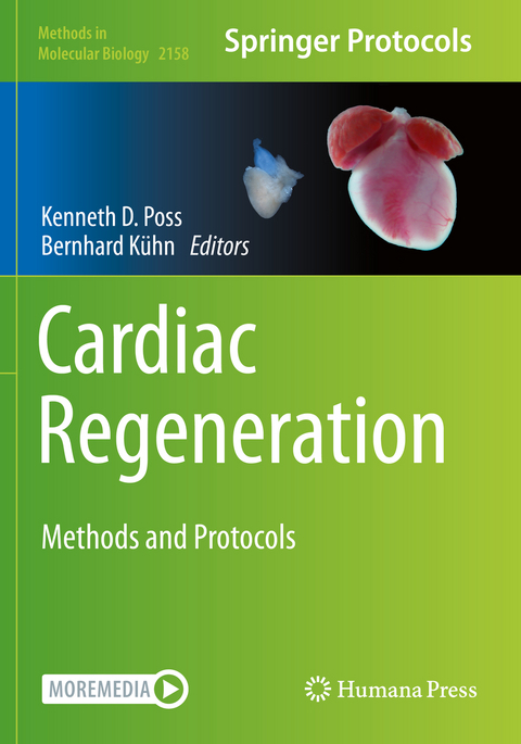 Cardiac Regeneration - 