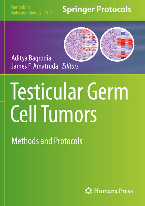 Testicular Germ Cell Tumors - 