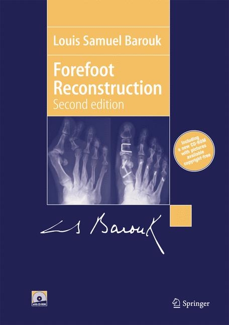 Forefoot Reconstruction -  Louis-Samuel Barouk