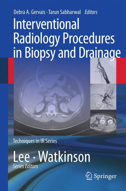 Interventional Radiology Procedures in Biopsy and Drainage - 