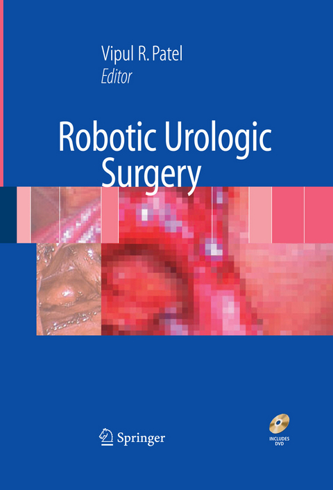 Robotic Urologic Surgery - 