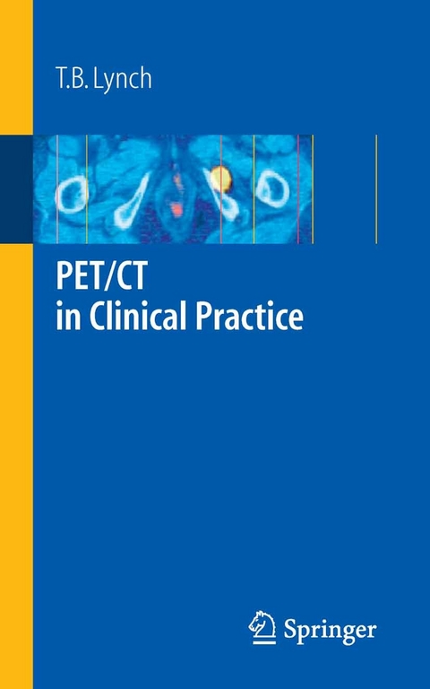 PET/CT in Clinical Practice -  T. B. Lynch