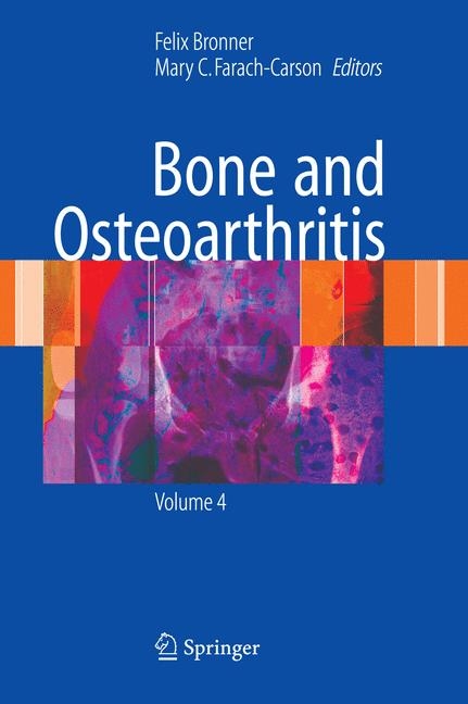 Bone and Osteoarthritis - 