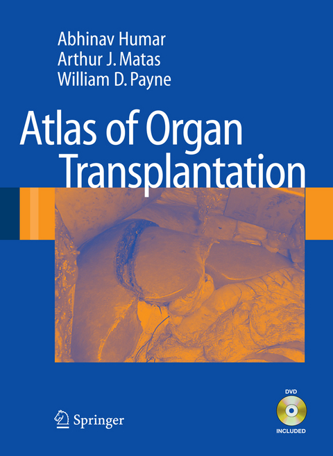 Atlas of Organ Transplantation -  Abhinav Humar,  Arthur J. Matas,  William D. Payne