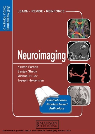 Neuroimaging -  Kirsten Forbes,  Joseph Heiserman,  Michael Lev,  Sanjay Shetty