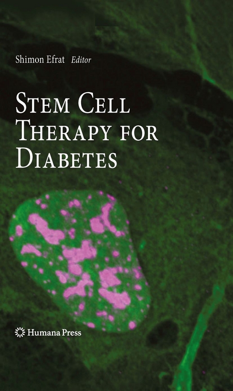Stem Cell Therapy for Diabetes - 