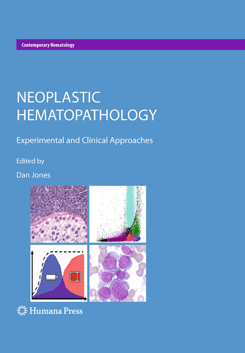 Neoplastic Hematopathology - 