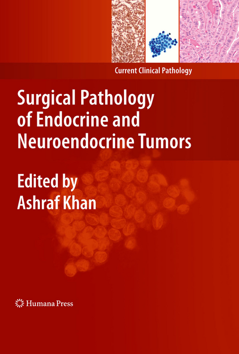 Surgical Pathology of Endocrine and Neuroendocrine Tumors - 