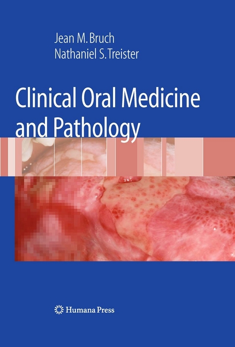 Clinical Oral Medicine and Pathology -  Jean M. Bruch,  Nathaniel Treister