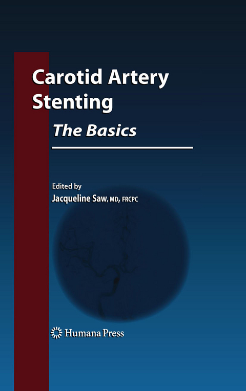 Carotid Artery Stenting: The Basics - 