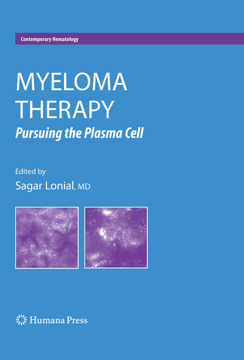 Myeloma Therapy - 