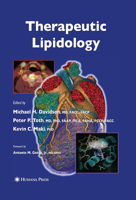 Therapeutic Lipidology - 