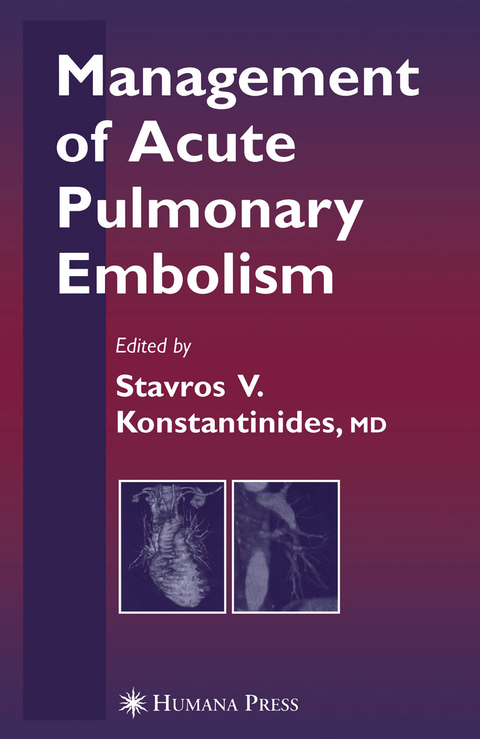 Management of Acute Pulmonary Embolism - 