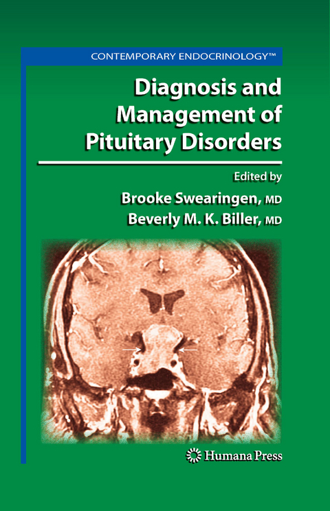 Diagnosis and Management of Pituitary Disorders - 