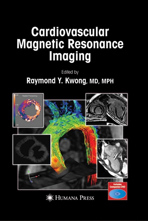 Cardiovascular Magnetic Resonance Imaging - 