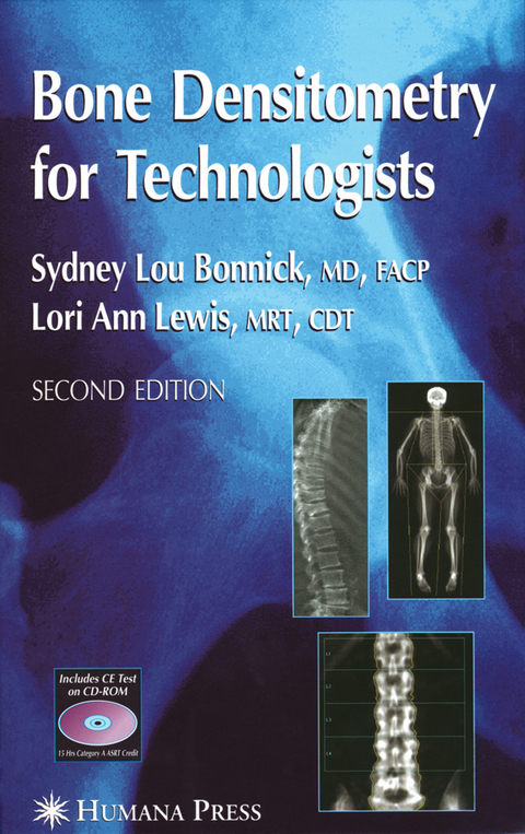 Bone Densitometry for Technologists -  Sydney Lou Bonnick