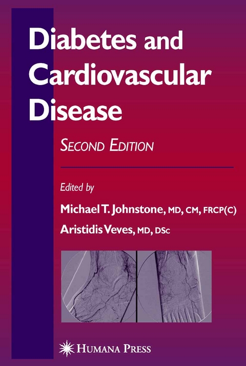 Diabetes and Cardiovascular Disease - 