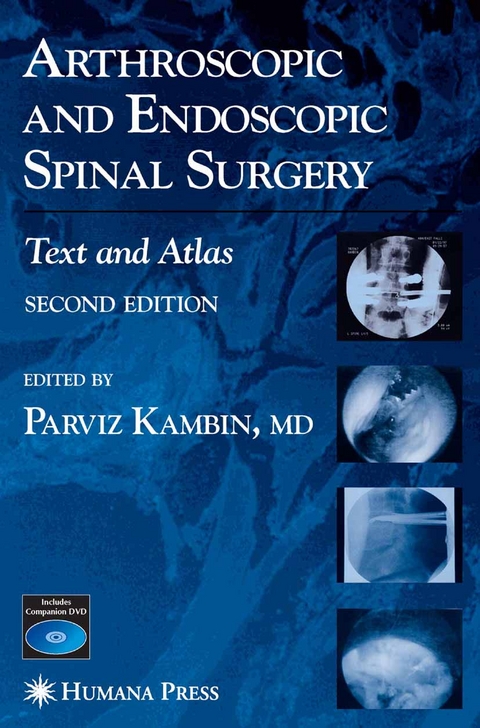 Arthroscopic and Endoscopic Spinal Surgery - 