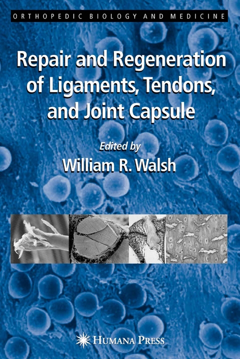 Repair and Regeneration of Ligaments, Tendons, and Joint Capsule - 