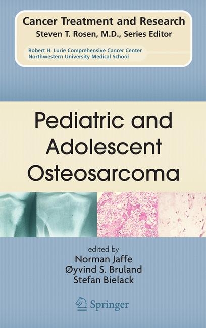 Pediatric and Adolescent Osteosarcoma - 